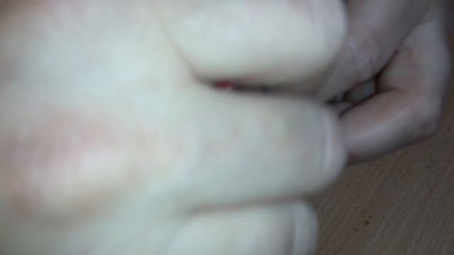 Выращивание перепелят - лечим вертолетиков. Перепела видео смотреть онлайн