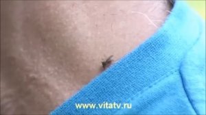 Комар от облысения (рецепт доктора Попова)