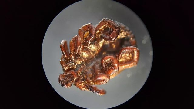 ИКСОДОВЫЙ КЛЕЩ ПОД МИКРОСКОПОМ