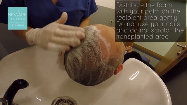 Lotion Application and Hair Wash- 4th Day After the Hair transplant- Dr. Ilker Apaydin in Istanbul смотреть онлайн