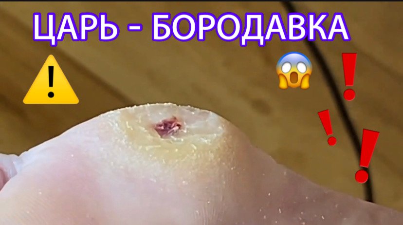 Царь-бородавка?⚠️❗️?? смотреть онлайн