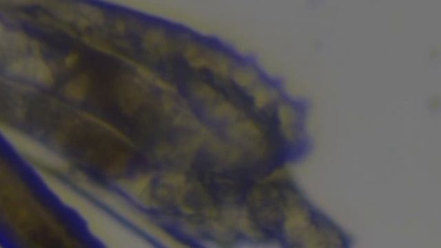 демодекс #demodex смотреть онлайн