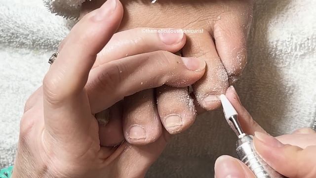 ?Pedicure Tutorial: How to Fix Pincer Toenails? смотреть онлайн