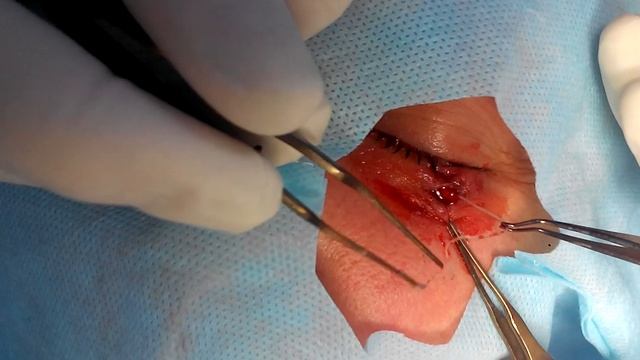 Дирофиляриоз смотреть онлайн