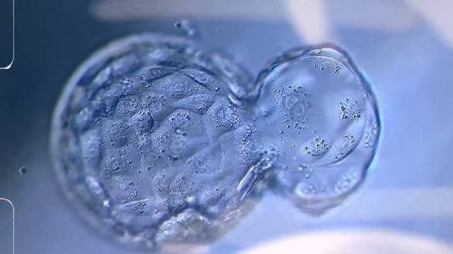 Хэтчинг, что это? Виды и показания смотреть онлайн