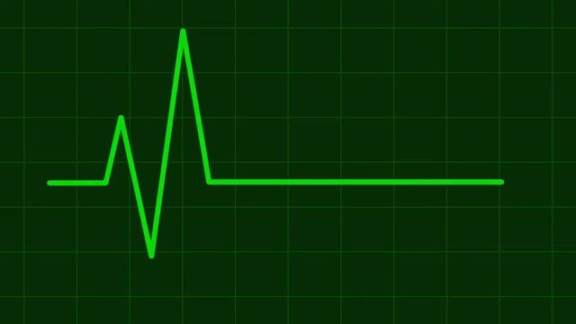 Анимация кардиограммы, пульс