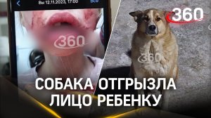 Откусила лицо: бездомная собака напала на девочку под Сургутом
