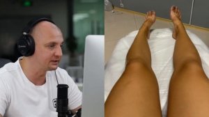 ОБУЧЕНИЕ ЛАЗЕРНОЙ ЭПИЛЯЦИИ НА ЛАЗЕРНОМ АППАРАТЕ. ТЕОРИЯ И ПРАКТИКА