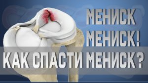 Разрывы, травмы, повреждения мениска. Резать или лечить?