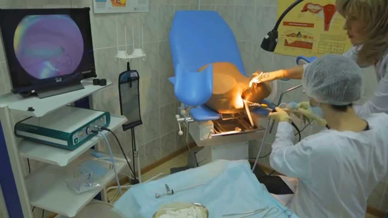 Практическое занятие для акушеров-гинекологов. Видеоролик. смотреть онлайн