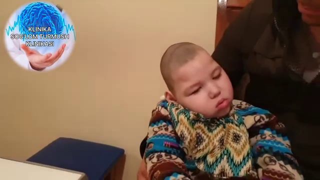 МИКРОЦЕФАЛИЯ И ВТОРИЧНАЯ ГИДРОЦЕФАЛИЯ. СИМПТОМАТИЧЕСКАЯ ЭПИЛЯЦИЯ смотреть онлайн