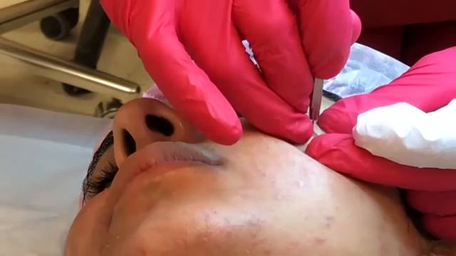 ГЛУБОКОЕ ОЧИЩЕНИЕ КОЖИ ЛИЦА В КАБИНЕТЕ КОСМЕТОЛОГА смотреть онлайн