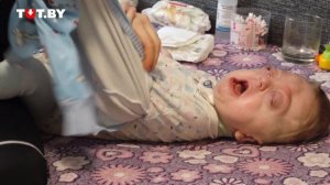 У моего сына синдром Пфайффера: Катя | Быть мамой