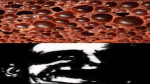 Трипофобия...?