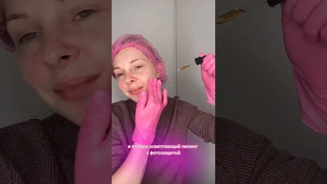 4 ПИЛИНГА СРАЗУ #пилинг #пилинглица #акне #лечениеакне #химическийпилинг #пилингприакне смотреть онлайн