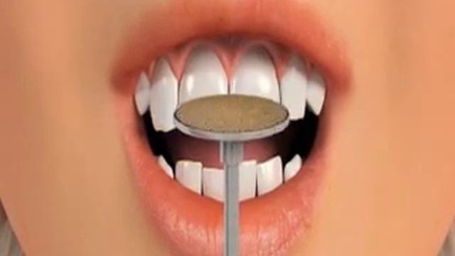 Correction of unequal teeth |Rajan dental смотреть онлайн