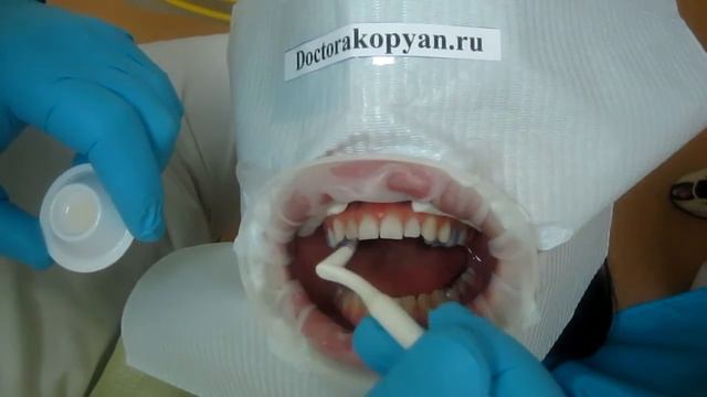 Люминиры установка. Часть 1 смотреть онлайн