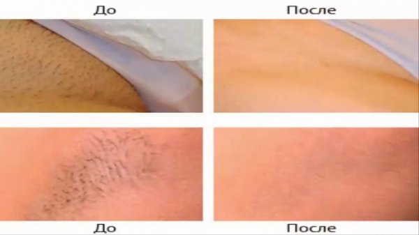 Крем для депиляции Fito Depilation