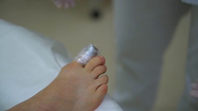 Фотодинамическая терапия (ФДТ) смотреть онлайн