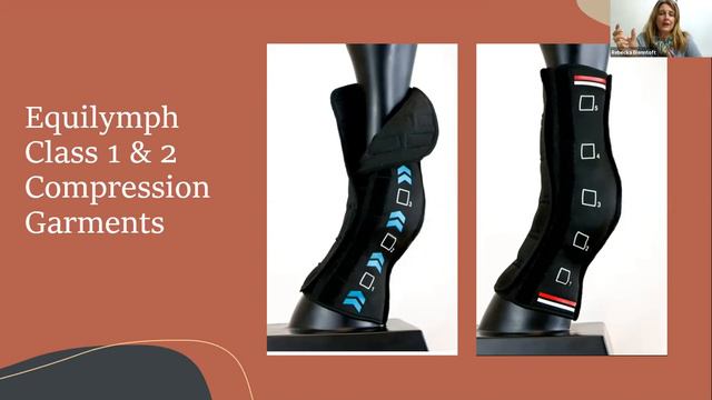 Chronic Progressive Lymphedema...Part II смотреть онлайн
