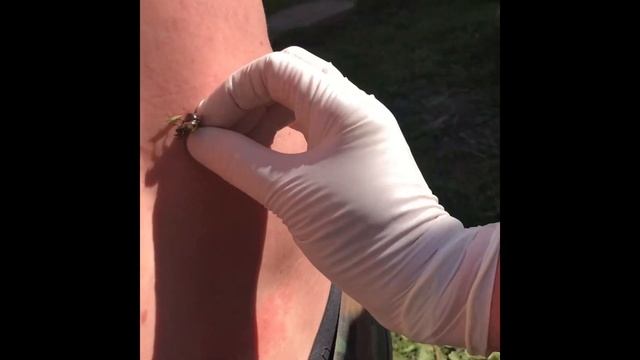 Апитерапия! Лечение пчёлами ! Apitherapy. Bee sting treatment. Народная медицина смотреть онлайн