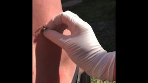 Апитерапия! Лечение пчёлами ! Apitherapy. Bee sting treatment. Народная медицина