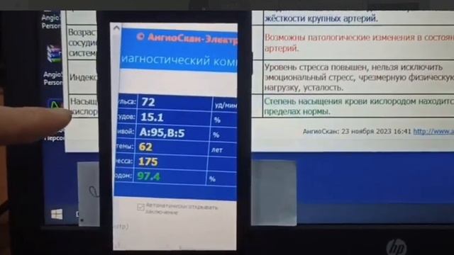 Тестируем продукт компании Jeunesse - Reserve. Впечатляет! Ангиоскан и биорезонанс. смотреть онлайн