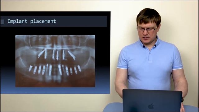 Лекция 4. Трансферы, аналоги. Инструменты для передачи информации технику смотреть онлайн