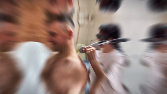 Лазерная эпиляция для мужчин смотреть онлайн