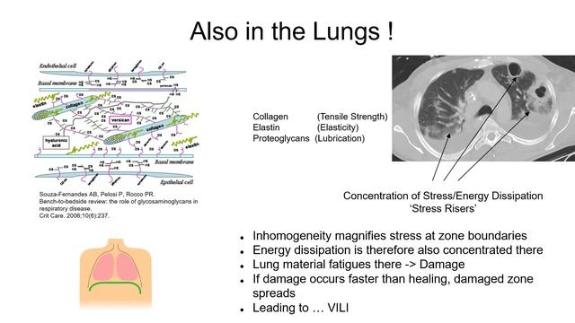 Physiology of positive pressure ventilation Tom Barnes