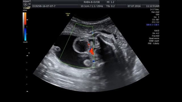 Киста яичника после родов и перед ними смотреть онлайн
