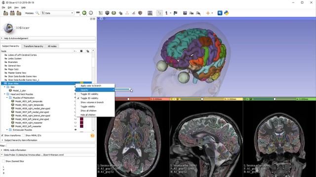 3D Slicer - Improvements in atlas management смотреть онлайн