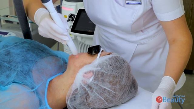 Лечение розацеа лазером смотреть онлайн