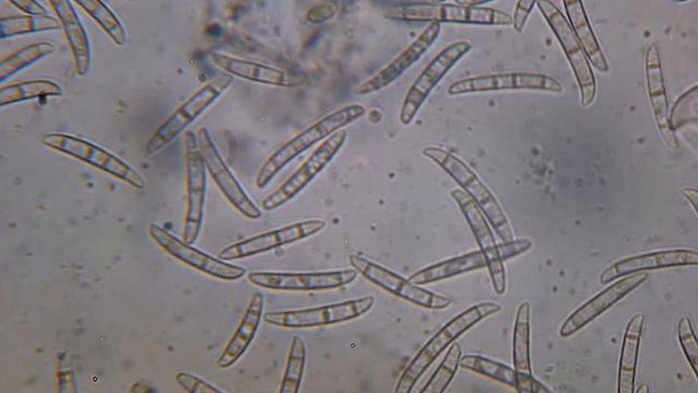 fusarium под микроскопом смотреть онлайн