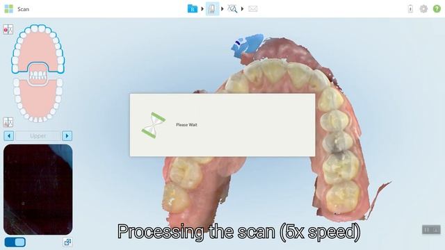 Itero Element 5D Full Arch Scanning as part of our Scanner Review! смотреть онлайн