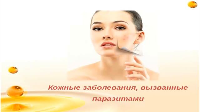 Вебинар по здоровью. Проблемы кожи - витилиго. смотреть онлайн