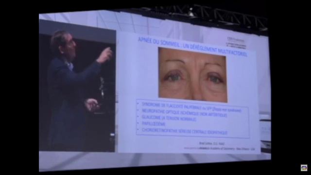 Конференция доктора Patrick VERET: « Апноэ во сне» 2018г смотреть онлайн