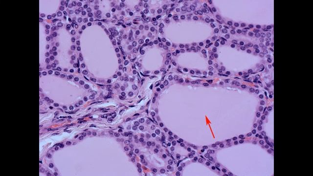 Эндокринная система. гистологические препараты