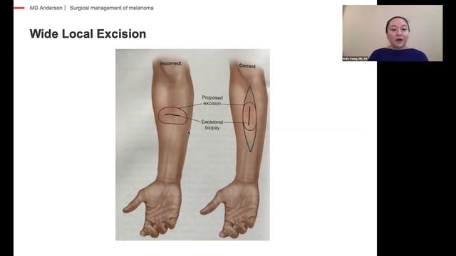 The Role of Surgery in Your Melanoma Treatment смотреть онлайн