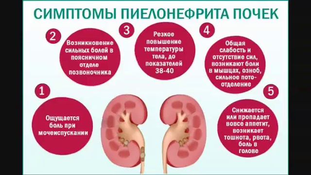 Отзыв лечившей ребенка от пиелонефрита. смотреть онлайн