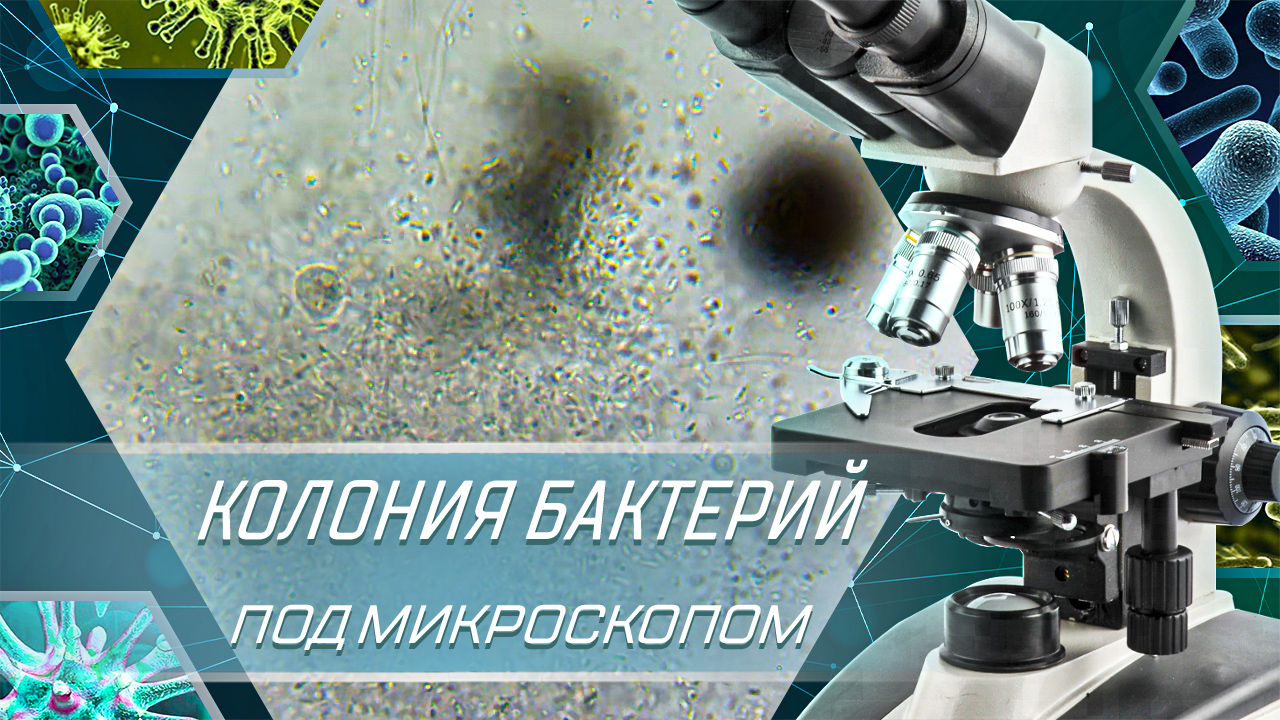 Колония бактерий под микроскопом - Капля воды из озера смотреть онлайн