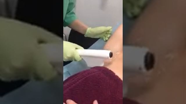 Мастер фотоэпиляции Анастасия смотреть онлайн