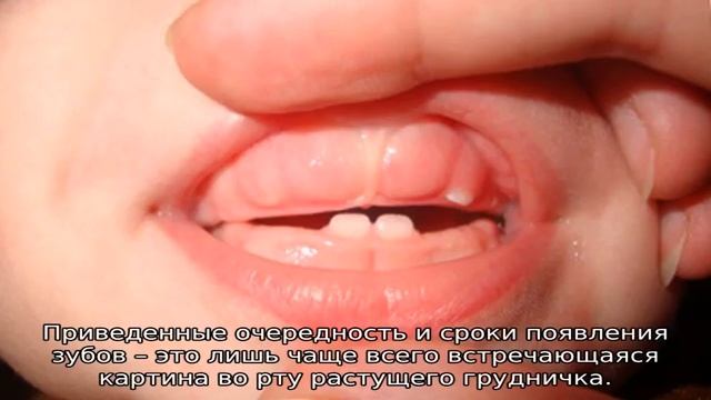 Как растут верхние зубы у младенцев — очередность смотреть онлайн