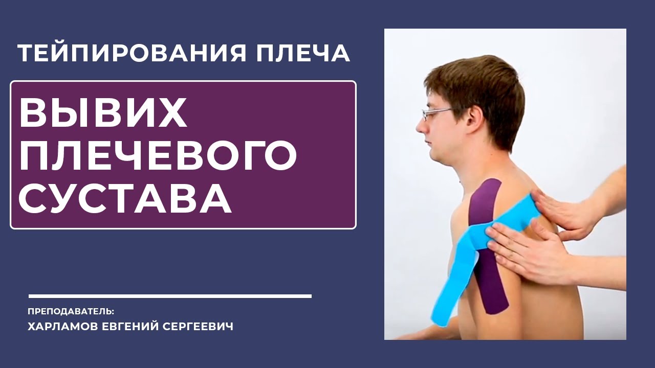 Тейпирование плеча. Вывих в плечевом суставе. смотреть онлайн