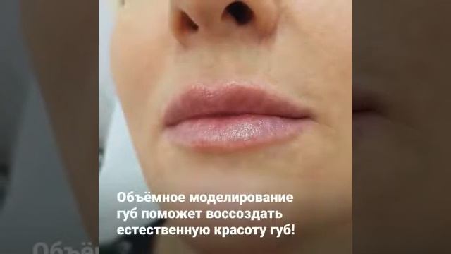 Увеличение губ!Шок цена 8000 руб.! смотреть онлайн