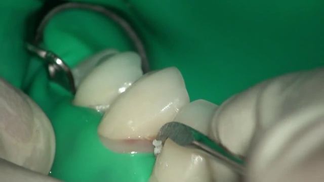 Эмалевый нож смотреть онлайн