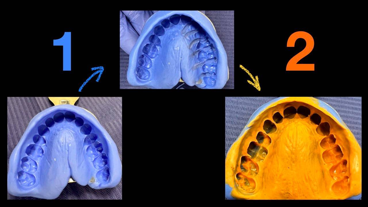 Снятие оттисков - Стоматолог лечит стоматолога #1 - ДВНЧС - ВНЧС - НМР