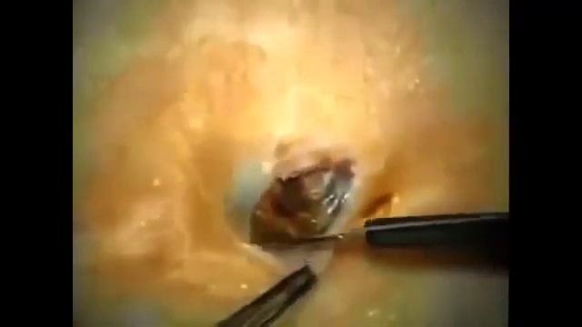 камедон(старая черная точка)