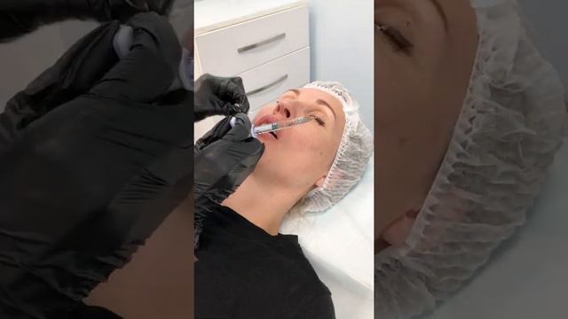 Увеличение губ процесс