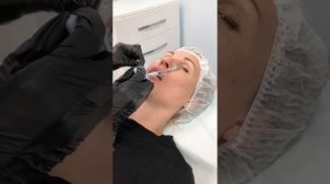 Увеличение губ процесс